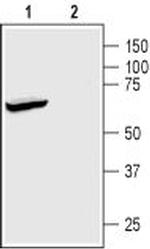 KCNK2 (TREK-1) Antibody in Western Blot (WB)