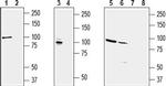 KCNQ2 Antibody in Western Blot (WB)