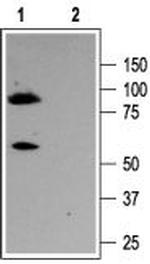 KCNQ3 Antibody in Western Blot (WB)