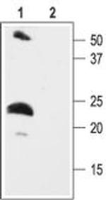 KCNE2 (MiRP1) Antibody in Western Blot (WB)