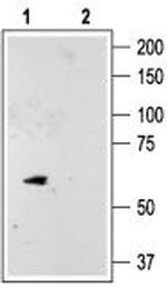 KCNK10 (TREK-2) Antibody in Western Blot (WB)