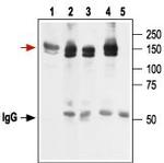 KCNH2 (HERG) Antibody in Immunoprecipitation (IP)