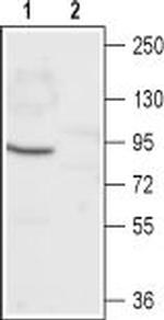 CNGA1 Antibody in Western Blot (WB)