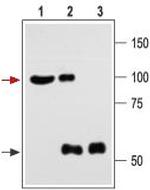 KCNMA1 (KCa1.1) (1184-1200) Antibody in Immunoprecipitation (IP)