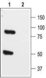 KCNK1 (TWIK-1) (extracellular) Antibody in Western Blot (WB)