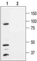 KCNK1 (TWIK-1) (extracellular) Antibody in Western Blot (WB)