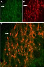 KCNH6 (erg2) Antibody in Immunohistochemistry (IHC)