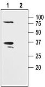 KV beta 2 Antibody in Western Blot (WB)