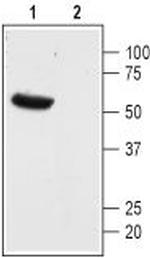 KCNK13 (THIK-1) (extracellular) Antibody in Western Blot (WB)