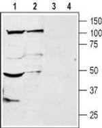 KCNK18 (TRESK) (extracellular) Antibody in Western Blot (WB)