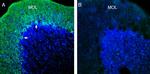 KCNT1 (Slack) Antibody in Immunohistochemistry (Frozen) (IHC (F))