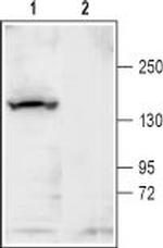 KCNT1 (Slack) Antibody in Western Blot (WB)