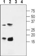 KCNE4 (MiRP3) Antibody in Western Blot (WB)