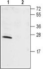 KChIP1 (KCNIP1) Antibody in Western Blot (WB)