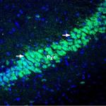 KChIP2 Antibody in Immunohistochemistry (Frozen) (IHC (F))