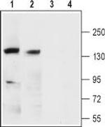 KCNMA1 (KCa1.1) (extracellular) Antibody in Western Blot (WB)
