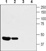 KV1.8 Antibody in Western Blot (WB)