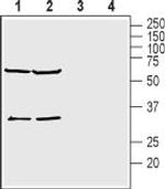 KCNK15 (TASK-5) (extracellular) Antibody in Western Blot (WB)