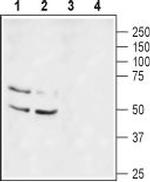 KV1.1 (KCNA1) (extracellular) Antibody in Western Blot (WB)