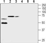 KV1.2 (KCNA2) (extracellular) Antibody in Western Blot (WB)