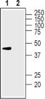 KCNK12 (THIK-2) (extracellular) Antibody in Western Blot (WB)