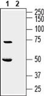 KCNK16 (TALK-1) (extracellular) Antibody in Western Blot (WB)