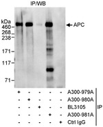 APC Antibody in Immunoprecipitation (IP)