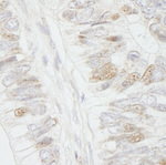 APC Antibody in Immunohistochemistry (IHC)