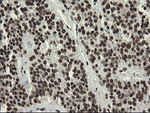 APEX1 Antibody in Immunohistochemistry (Paraffin) (IHC (P))