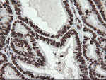 APEX1 Antibody in Immunohistochemistry (Paraffin) (IHC (P))