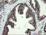 APEX1 Antibody in Immunohistochemistry (Paraffin) (IHC (P))