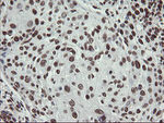 APEX1 Antibody in Immunohistochemistry (Paraffin) (IHC (P))