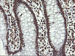 APEX1 Antibody in Immunohistochemistry (Paraffin) (IHC (P))