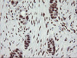 APEX1 Antibody in Immunohistochemistry (Paraffin) (IHC (P))