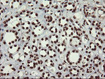 APEX1 Antibody in Immunohistochemistry (Paraffin) (IHC (P))