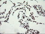 APEX1 Antibody in Immunohistochemistry (Paraffin) (IHC (P))