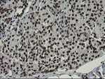 APEX1 Antibody in Immunohistochemistry (Paraffin) (IHC (P))