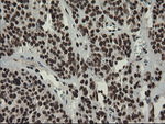 APEX1 Antibody in Immunohistochemistry (Paraffin) (IHC (P))