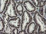 APEX1 Antibody in Immunohistochemistry (Paraffin) (IHC (P))