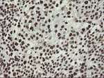 APEX1 Antibody in Immunohistochemistry (Paraffin) (IHC (P))