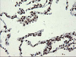 APEX1 Antibody in Immunohistochemistry (Paraffin) (IHC (P))