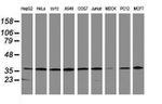 APEX1 Antibody in Western Blot (WB)