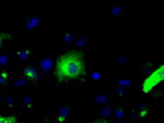 APP Antibody in Immunocytochemistry (ICC/IF)