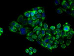 APP Antibody in Immunocytochemistry (ICC/IF)