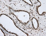 APP Antibody in Immunohistochemistry (Paraffin) (IHC (P))