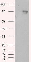 APP Antibody in Western Blot (WB)