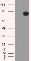 APP Antibody in Western Blot (WB)