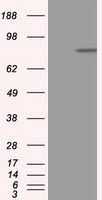 APP Antibody in Western Blot (WB)