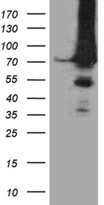 APPL2 Antibody in Western Blot (WB)