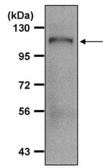 Amyloid Precursor Protein Antibody in Immunoprecipitation (IP)